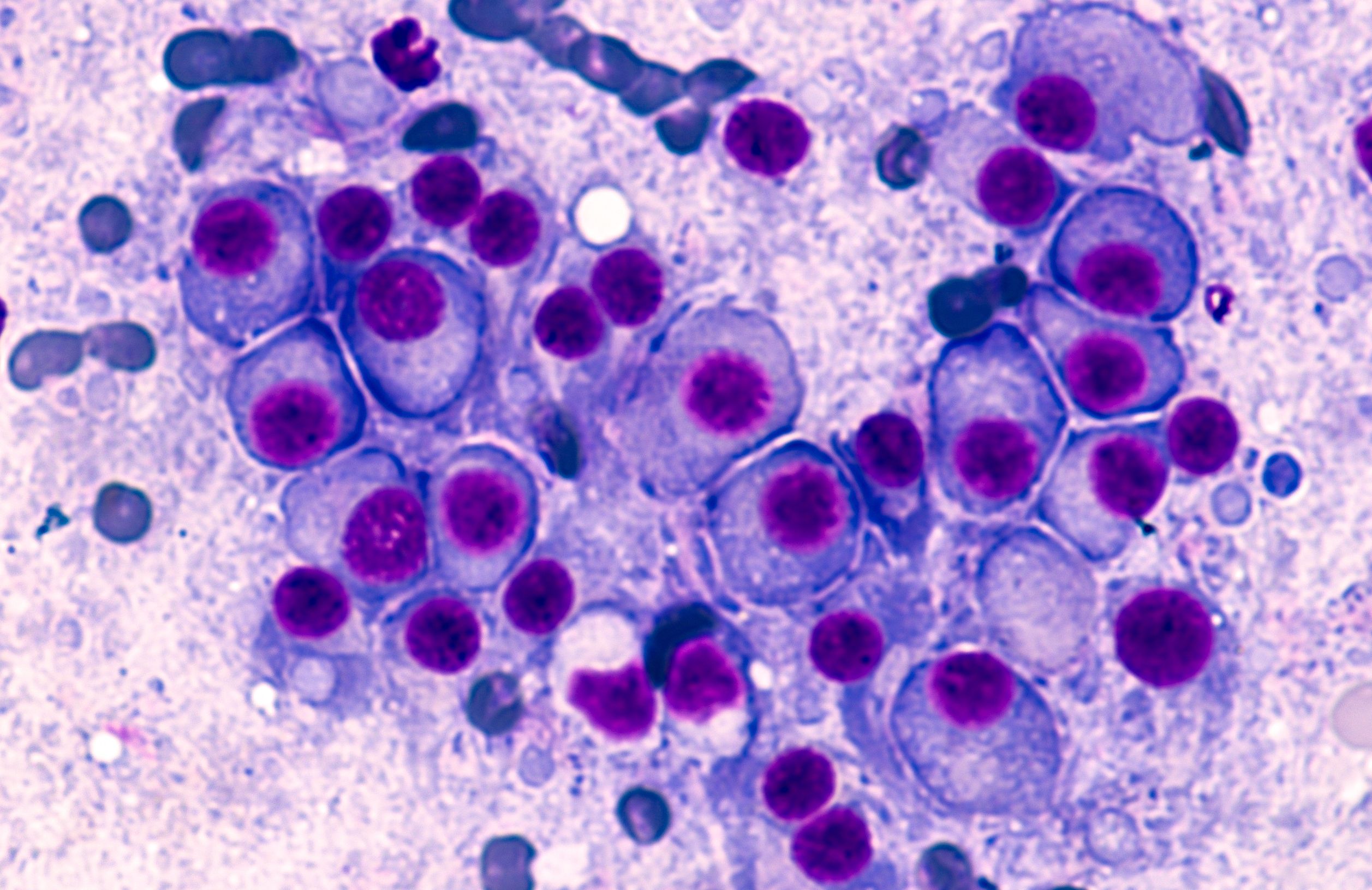 Microscopic view of MM