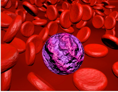 EP. 15 Acute Myeloid Leukemia Practice Pearls: Considerations for Formulary Decisions