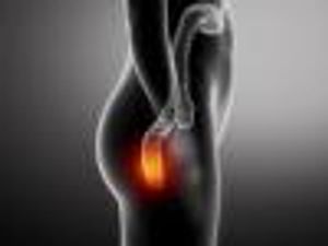 Circulating Tumor Cell Test Effective Detecting Precancerous Lesions