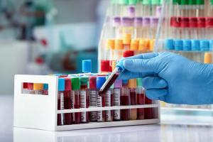 Phase 3 BRUIN CLL-322 Trial Supports Fixed-Duration Pirtobrutinib Regimen as Potential New Standard in Relapsed/Refractory CLL