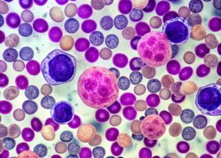 Video: Pharmacists Take Center Stage in Delivering Linvoseltamab, Advancing Myeloma Care