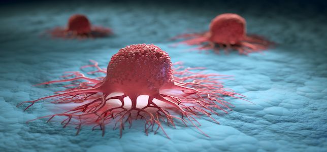 Trial Evaluating Avelumab in Epithelial Ovarian Cancer Fails to Meet ...