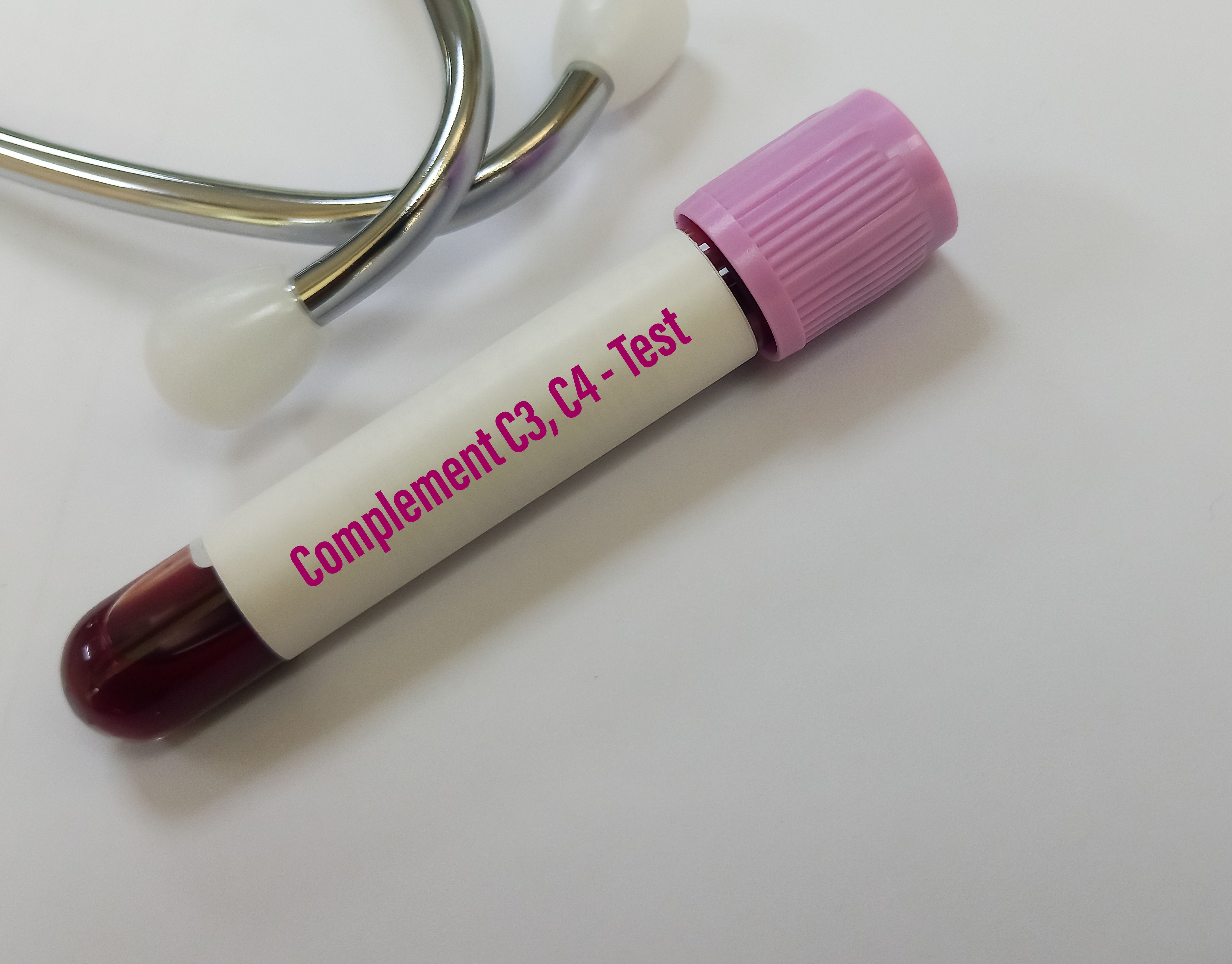 Blood test for C3, C4 protein detection | Image Credit: © MdBabul - stock.adobe.com