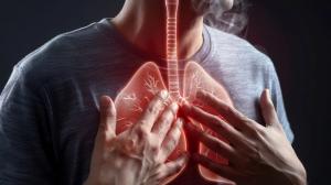 Lung disease a group of lung conditions that includes sarcoidosis, idiopathic pulmonary fibrosis and autoimmune. Lung infection, Lung Cancer, Asthma, Tuberculosis, COPD - Image credit: Thipphaphone | stock.adobe.com