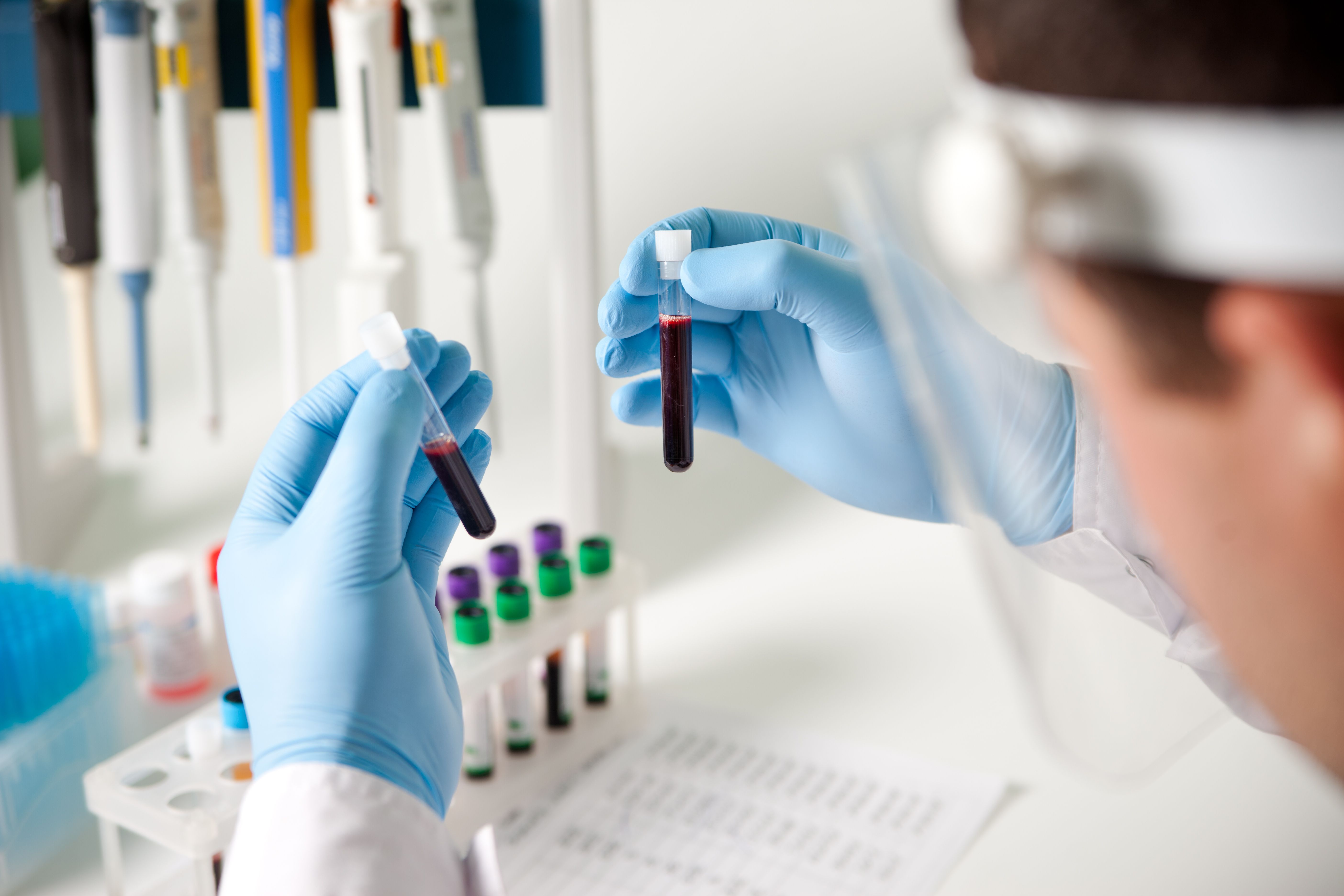 Laboratory scientist looking at test tubes with blood and analysis -- Image Credit: Анна Ковальчук | stock.adobe.com