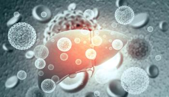 Liver Infection with hepatitis viruses | Image Credit: bluebay2014 - stock.adobe.com