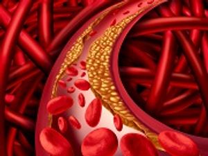 PCSK9 Access Challenges Highlights AJPB Week in Review