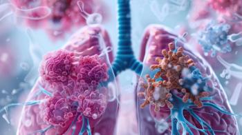 medical illustration, split screen anatomical comparison showing healthy functioning lung on left side with clear airways and normal tissue, versus lung cancer affected lung on right side | Image Credit: Anton | stock.adobe.com