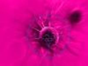 What Factors Influence Response to Multiple Myeloma Treatment?