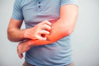 People scratch the itch with hand, Elbow, itching, Healthcare And Medicine, Men with skin problem concept