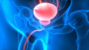 Early Experience Using Intravesical Gene Therapy for NMIBC: Perspectives from Urinary Oncologists