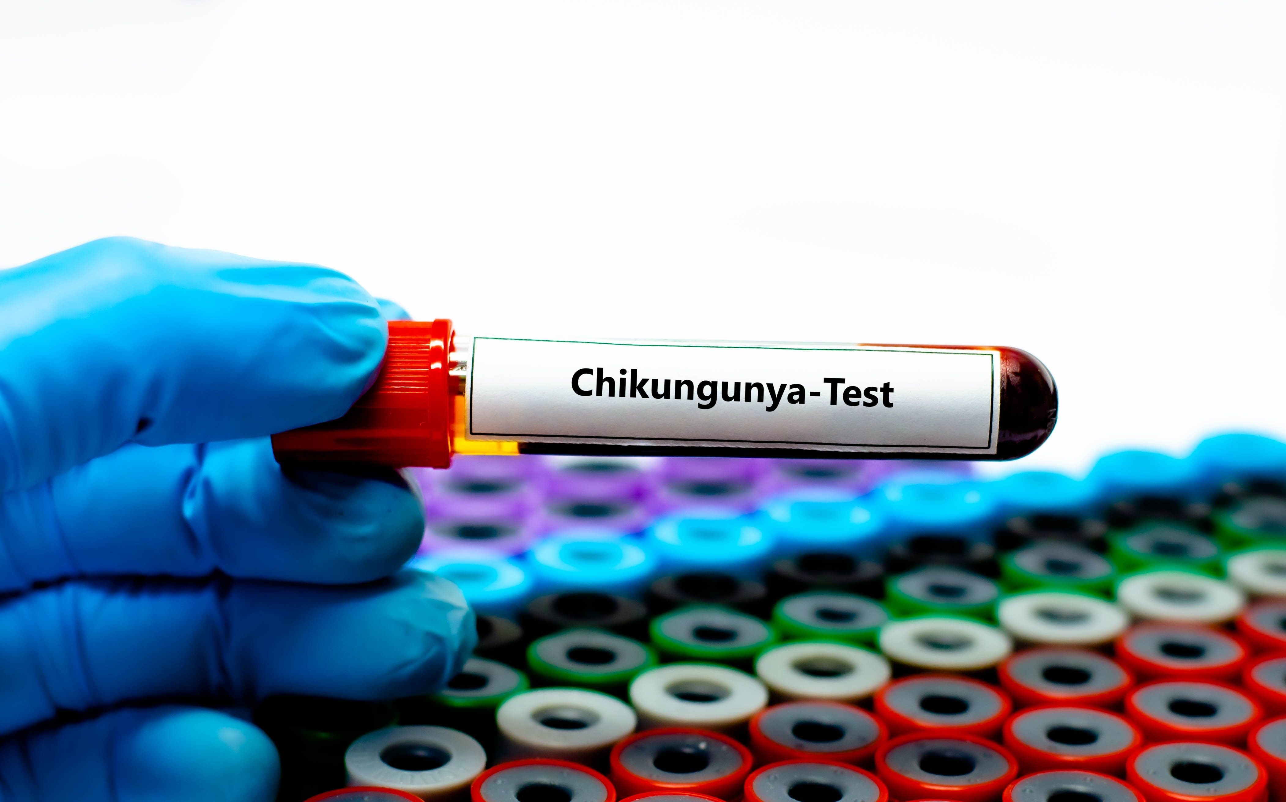 Blood sample tube for chikungunya test analysis. | Image Credit: kitsawet | stock.adobe.com