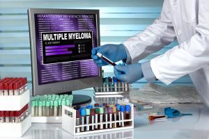 Blood sample positive for multiple myeloma -- Image credit: angellodeco | stock.adobe.com
