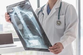 Doctor with radiological chest x-ray film for medical diagnosis on patient’s health on asthma, lung disease and bone cancer illness - Image credit: Chinnapong | stock.adobe.com