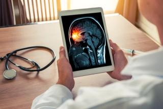 Doctor holding a digital tablet with x-ray of brain and skull skeleton. Headache, meningitis and migraine concept - Image credit: Steph photographies | stock.adobe.com