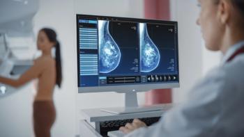 Computer Screen in Hospital Radiology Room: Woman Standing Undergoing Mammography Screening Procedure. Screen Showing the Mammogram Scans of Dense Breast Tissues - Image credit: Gorodenkoff | stock.adobe.com