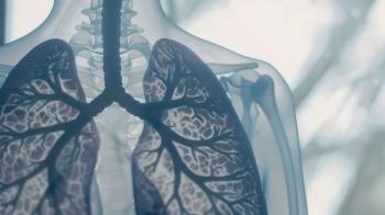 Pulmonary fibrosis - a serious lung condition. Pulmonary fibrosis can cause breathing difficulties and requires careful medical attention