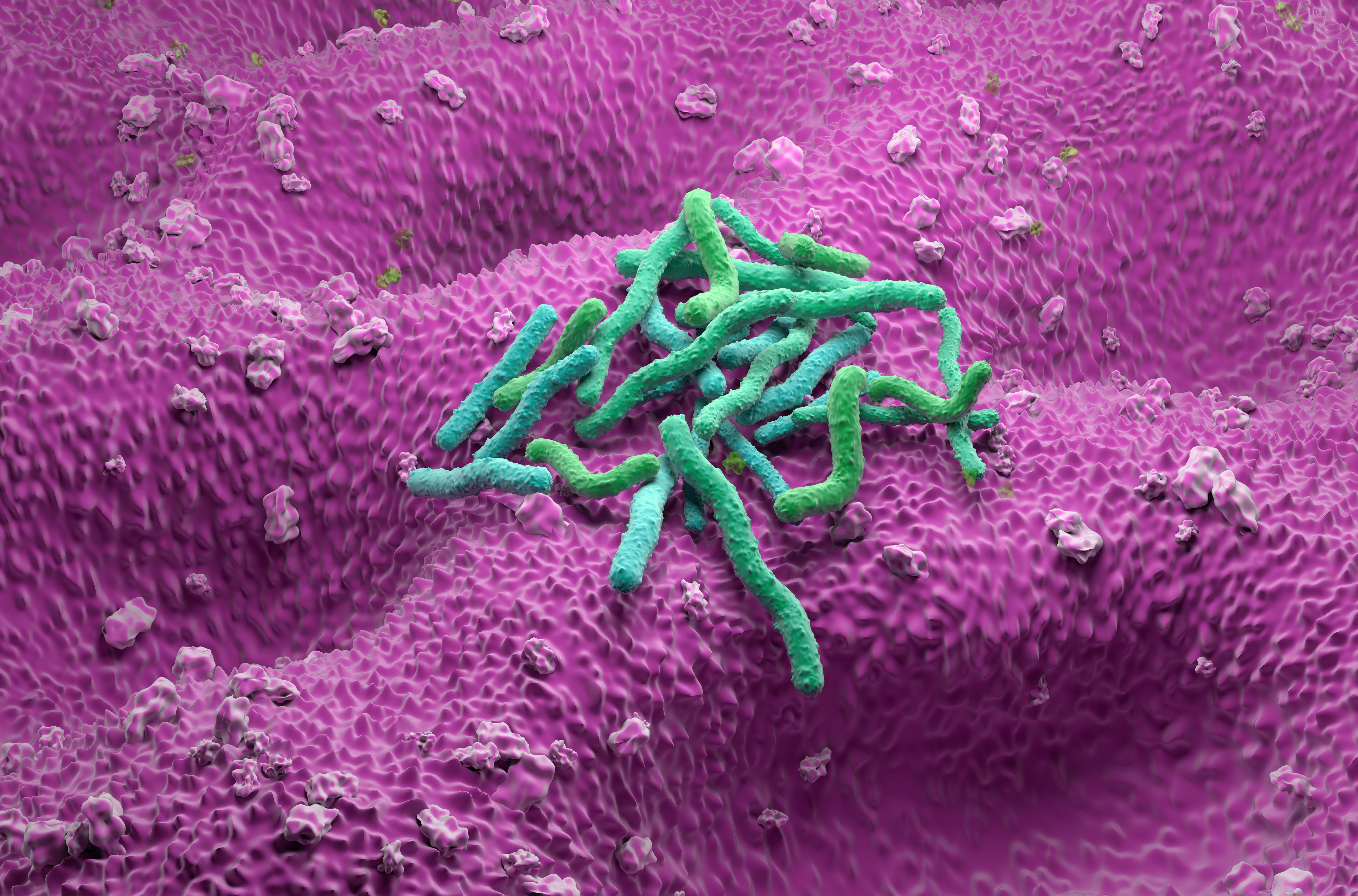 Updated Clinical Guidelines Outline Optimal Treatment of Helicobacter pylori Infection