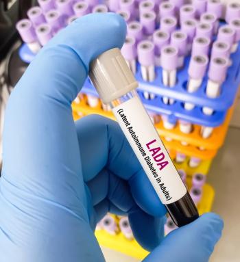 Blood sample for LADA(type-1.5 diabetes) or Latent Autoimmune Diabetes in Adults Test. It is an autoimmune disease that begins in adulthood and does not require insulin. | Image Credit: MdBabul | stock.adobe.com