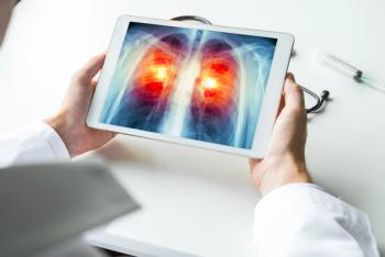 Doctor watching a xray of lung cancer on digital tablet. Radiology concept | Image Credit: steph photographies | stock.adobe.com