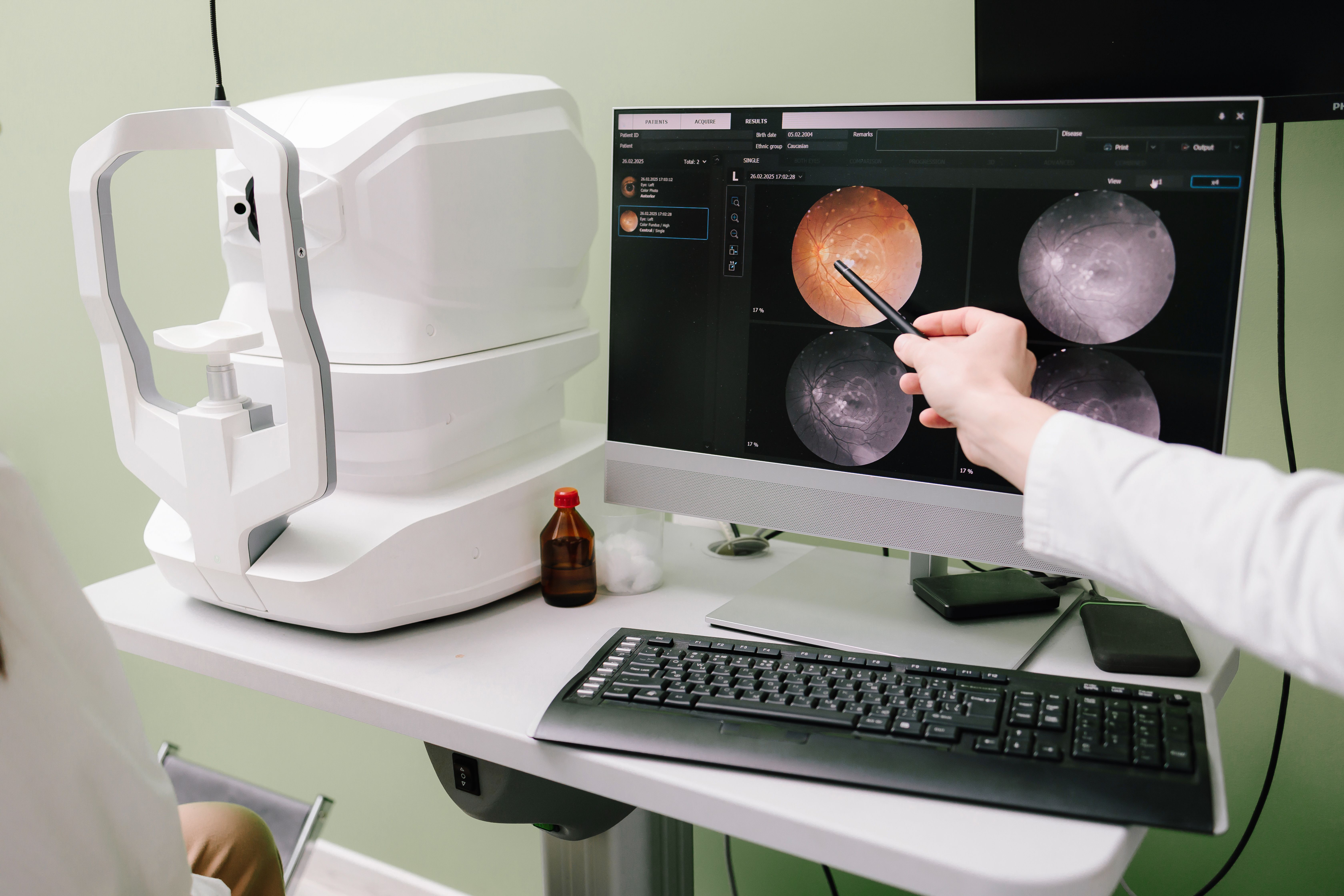 Eye scan showing macular degeneration -- Image credit: Rabizo Anatolii | stock.adobe.com