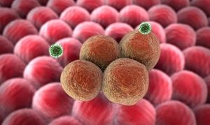 The Growing Role of PARP Inhibitors in Ovarian Cancer