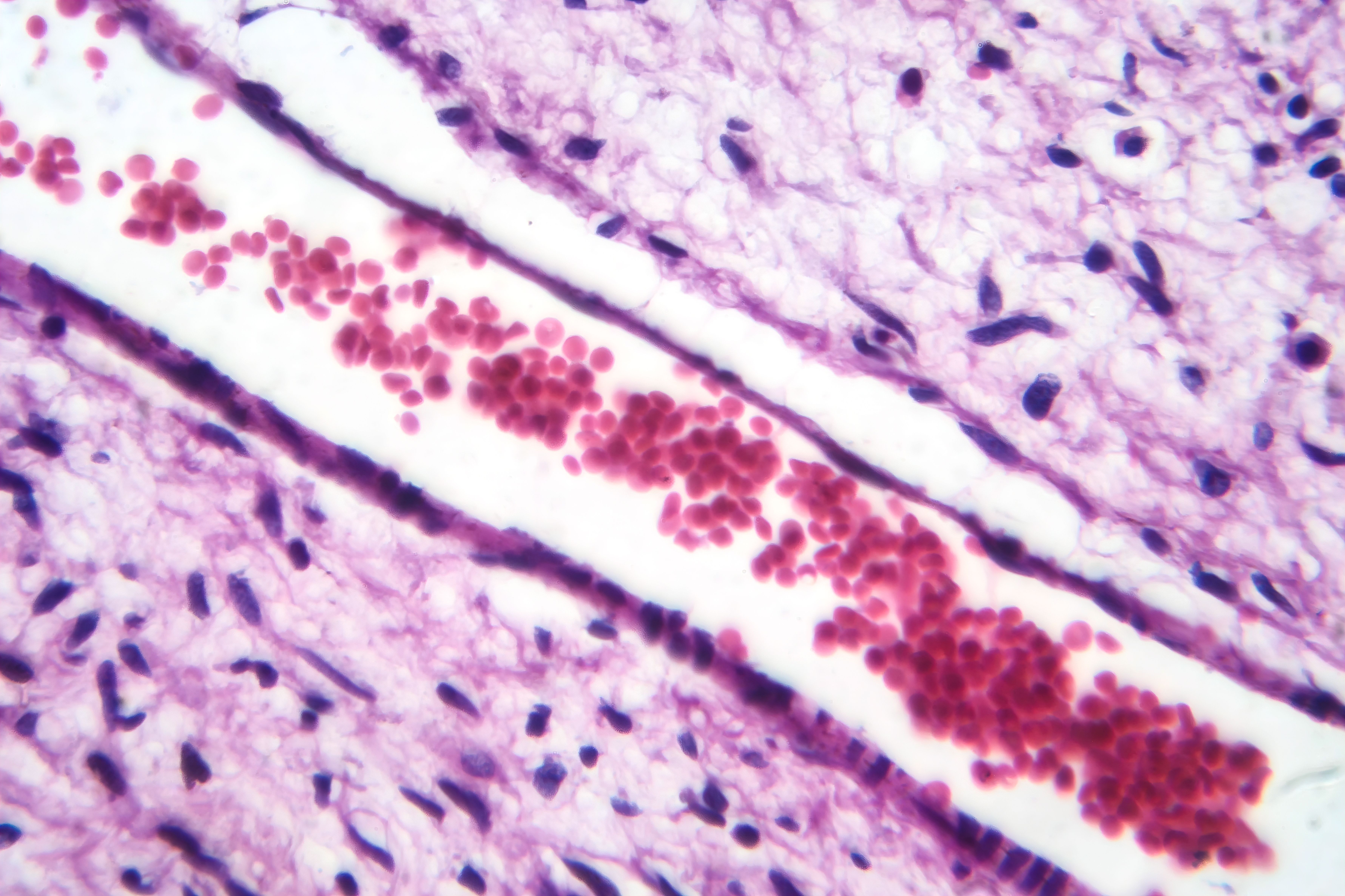 A small blood vessel with red blood cells in neurofibroma tissue sample, light micrograph | Image Credit: Dr_Microbe | stock.adobe.com