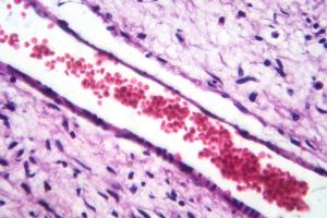A small blood vessel with red blood cells in neurofibroma tissue sample, light micrograph | Image Credit: Dr_Microbe | stock.adobe.com