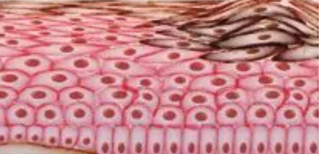 Pharmacists Can Help Patients with Melanoma Monitor Immune-Related Adverse Events When Starting Newly Approved Immunotherapies