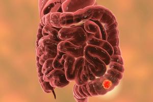 Image credit: Dr_Microbe | stock.adobe.com