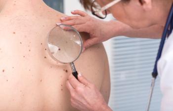 Dermatologist looking at skin for skin cancer -- Image credit: thodonal | stock.adobe.com