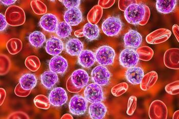 Acute lymphoblastic leukemia -- Image credit: Dr_Microbe | stock.adobe.com