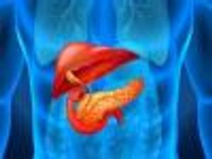 Urban African Americans Get Pancreatic Cancer Much Younger, Study Finds