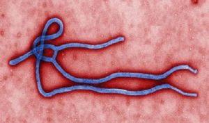 FDA Approves Ebola Rapid Test