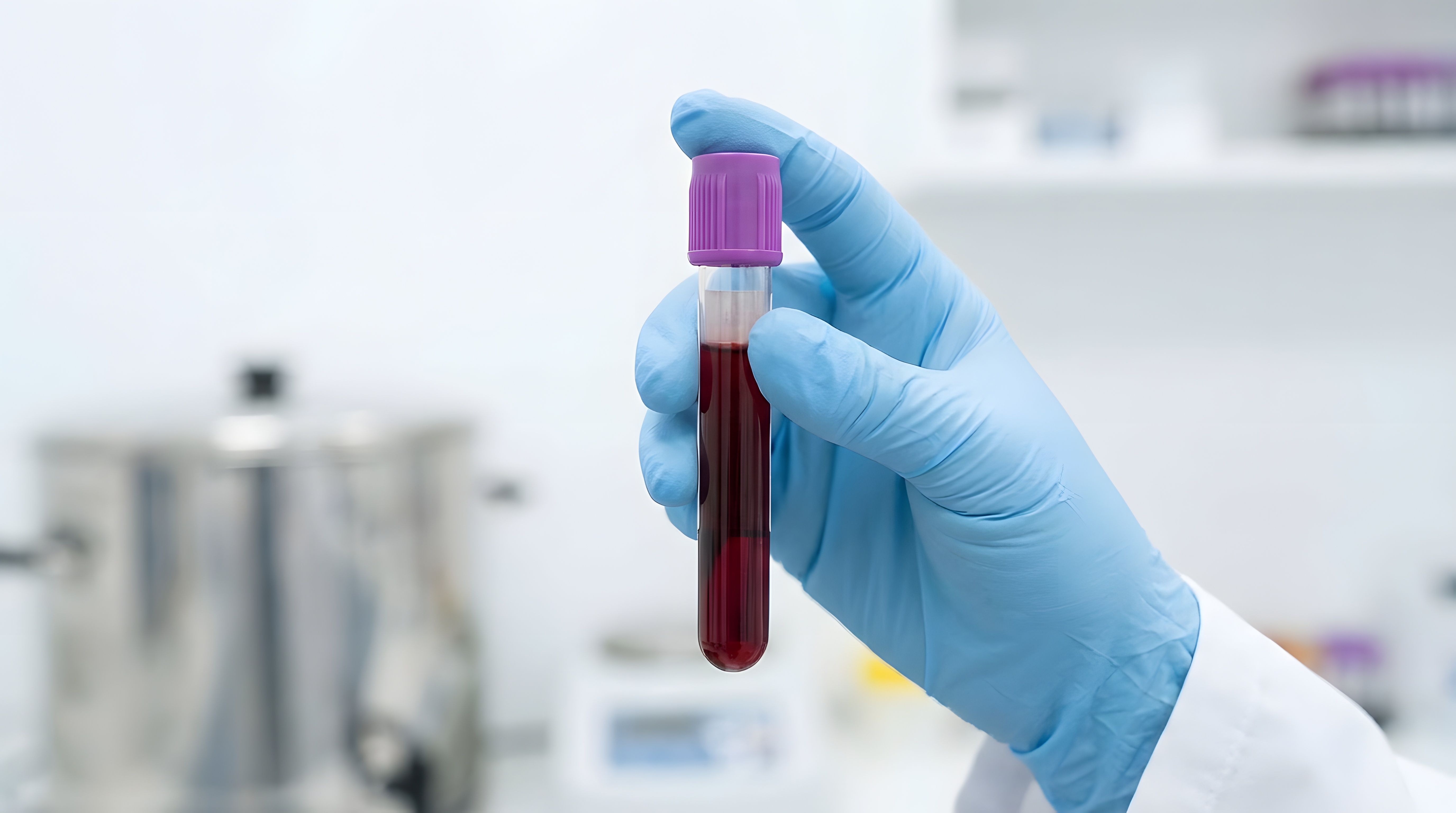 Gloved hand holding blood sample test tube in laboratory, medical diagnostics and healthcare testing concept, clinical research and analysis in modern ... See More | Image Credit: © Raj - stock.adobe.com