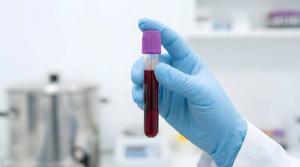 Gloved hand holding blood sample test tube in laboratory, medical diagnostics and healthcare testing concept, clinical research and analysis in modern ... See More | Image Credit: © Raj - stock.adobe.com