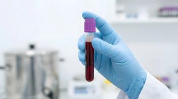 Gloved hand holding blood sample test tube in laboratory, medical diagnostics and healthcare testing concept, clinical research and analysis in modern ... See More | Image Credit: © Raj - stock.adobe.com