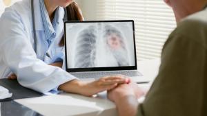Doctor explaining lung cancer screening results to patient | Image Credit: © Nattakorn - stock.adobe.com