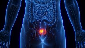 FDA Approves Enfortumab Vedotin Plus Pembrolizumab for Muscle-Invasive Bladder Cancer