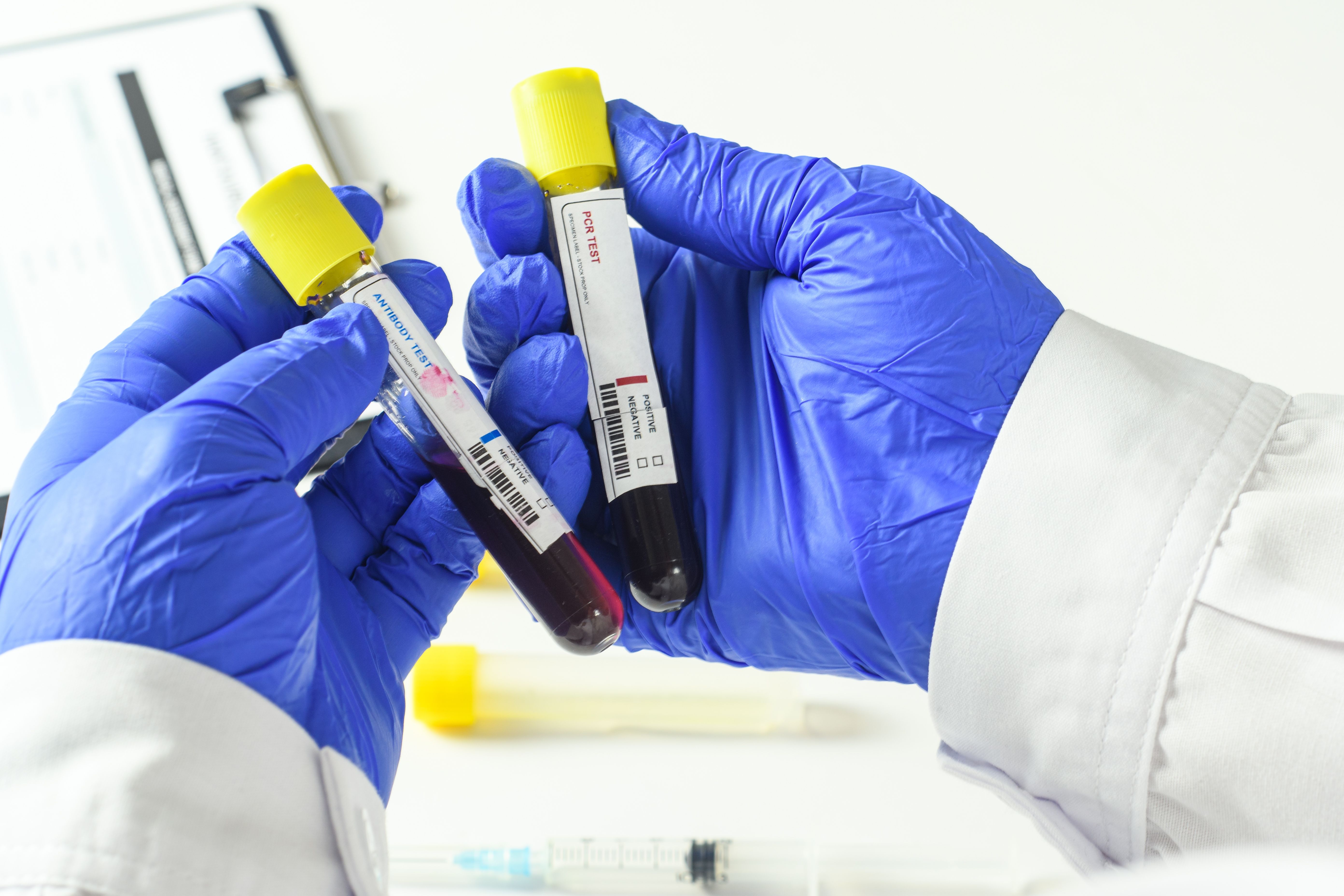 What Pharmacists Need to Know as Ebola Cases Climb in the Democratic Republic of the Congo and Uganda