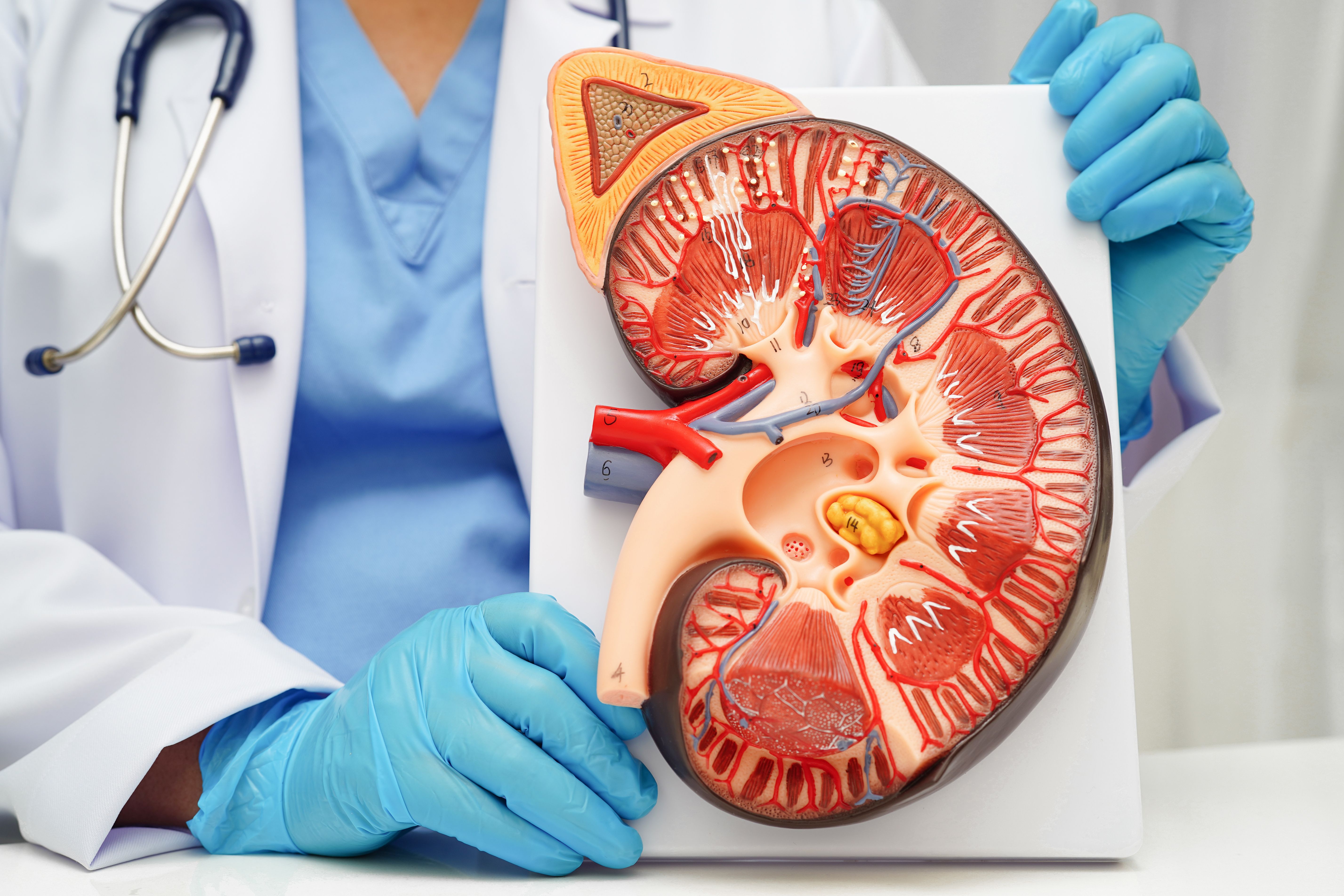 Model of chronic kidney disease (CKD) -- Image credit: kanruthai | stock.adobe.com