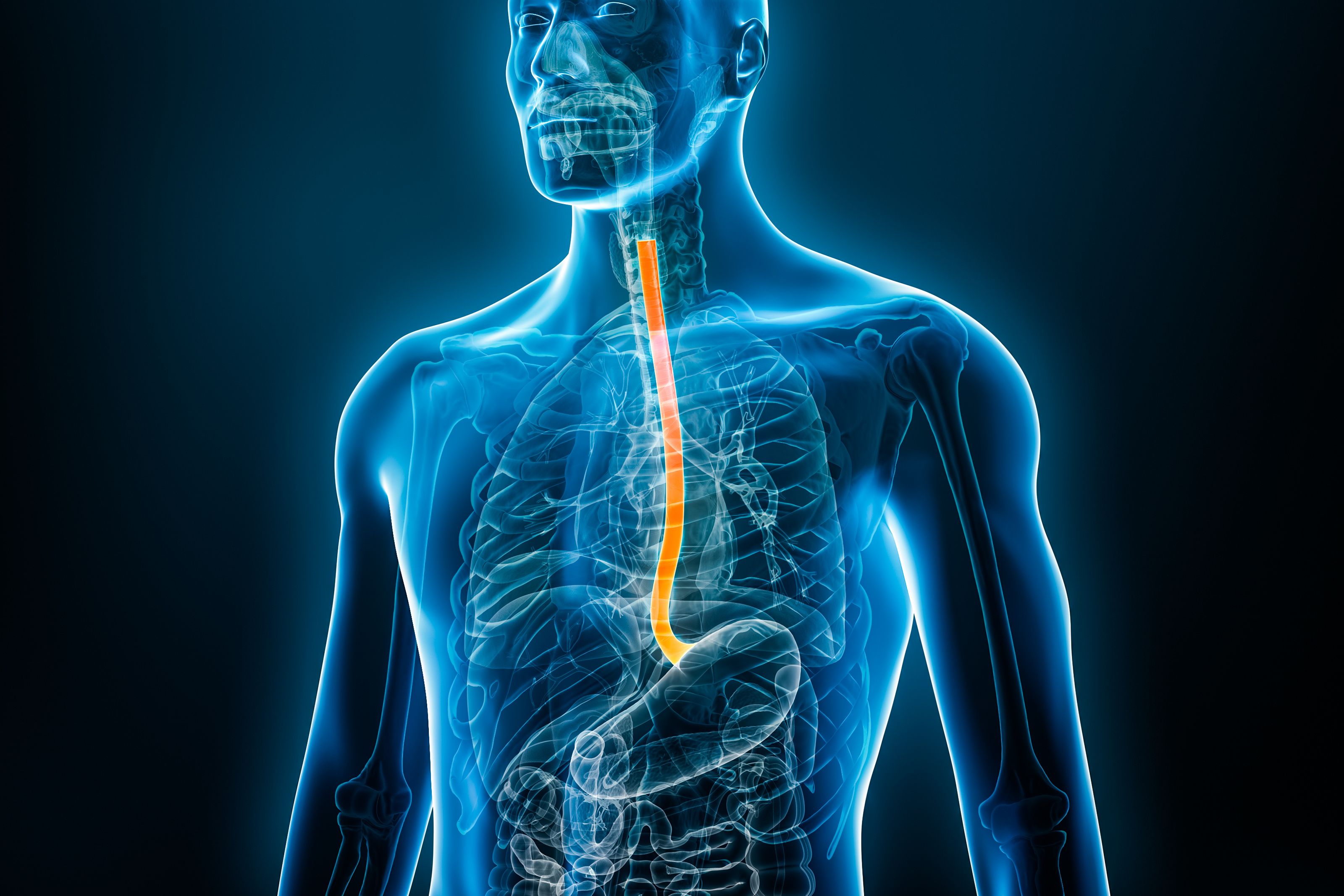 Phase 3 Trial Highlights Efficacy of Dupilumab for EoE in Children Aged 1 to 11