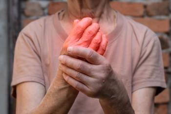 Hand joints inflammation. Concept of rheumatic arthritis, rheumatism, gout, joint swelling or arthralgia - Image credit: ZAY WIN HTAI | stock.adobe.com