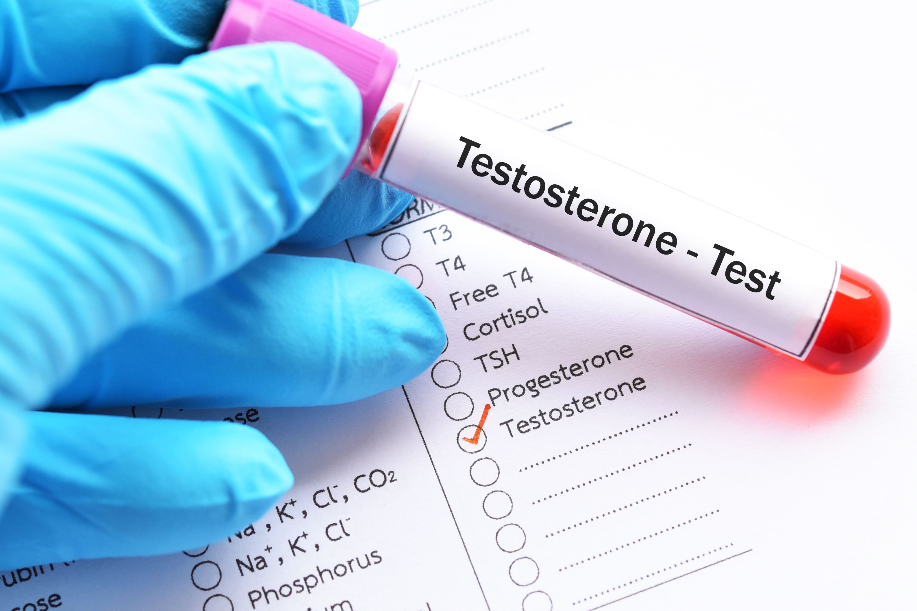 Blood sample for testosterone hormone testBlood sample for testosterone hormone test - Image credit: jarun011 | stock.adobe.com