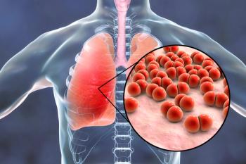 Pneumococcal pneumonia, bacteria Streptococcus pneumoniae in human lungs | Image Credit: Dr_Microbe - stock.adobe.com