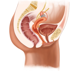 Oncology Overview: Enfortumab vedotin-ejfv for Advanced or Metastatic Urothelial Cancer