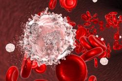 Omidubicel Shows Clinical Benefit at 3 Years for Individuals With Hematologic Malignancies