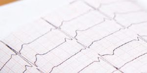 Pharmacist Management of Hyperkalemia: A Focus on Improving Clinical Outcomes