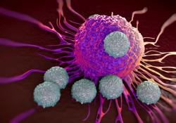 Cabozantinib, Nivolumab, Ipilimumab Combination Does Not Reach PFS