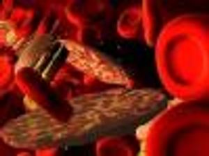 PCSK9 Inhibitors: Who are the Best Candidates for Therapy?